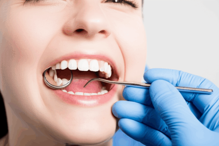 Are Veneers Popular in Korea Unpacking the K Beauty Smile Trend