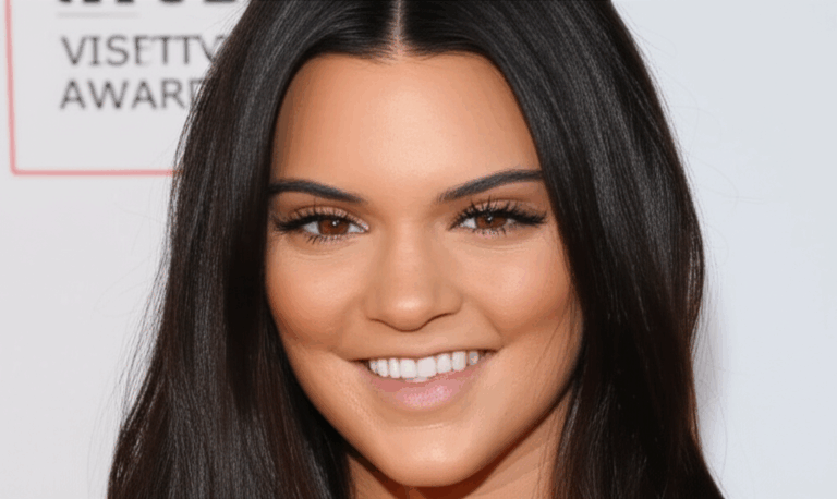 Did Kendall Jenner Get Veneers My Personal Journey Exploring Her Smile Transformation