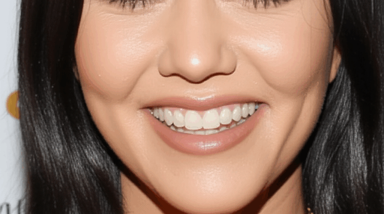 Did Kourtney Kardashian Get Veneers An Investigative Look at Her Smile Transformation